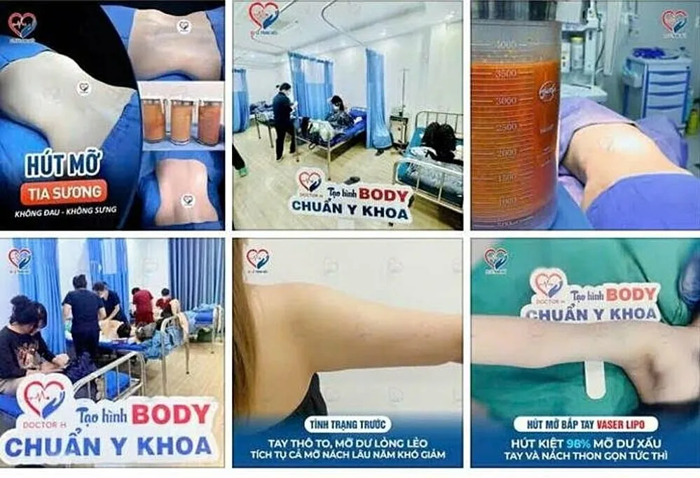 Quảng cáo của thẩm mỹ Julia Aesthetic. Ảnh: Công an cung cấp